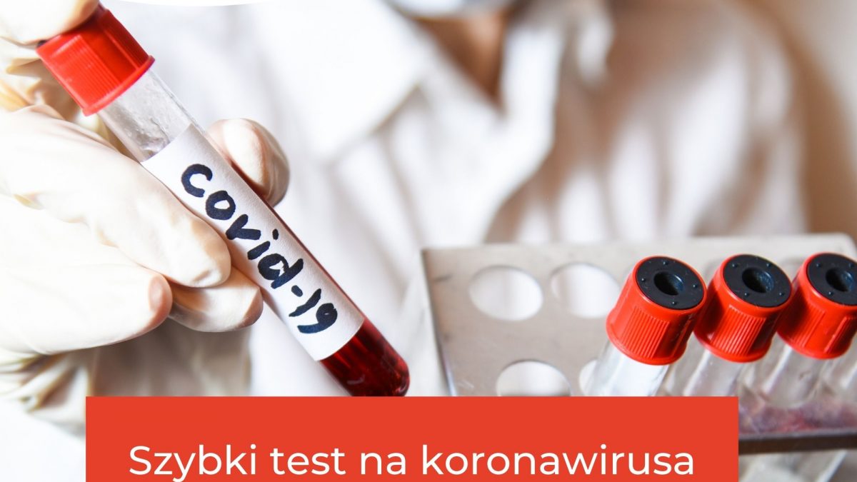 Szybki test na koronawirusa?